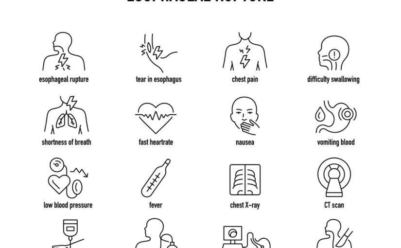 Esophageal Rupture vector icon set Line editable medical icons